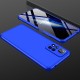 Чехол Xiaomi Redmi Note 11 Pro (China) / Redmi Note 11 Pro Plus 5G / 11i Fullcover 4D